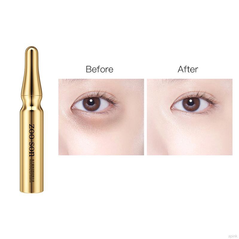 Serum mắt trứng cá muối Zoo:Son dưỡng mắt dạng lăn xoá quầng thâm/bọng mắt, nâng cơ mắt- Hanayuki Asia