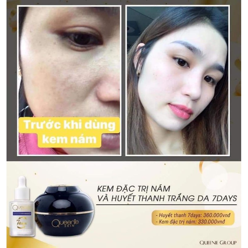 KEM NÁM, TÀN NHANG QUEENIE SKIN