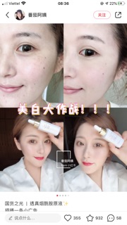 (CHÍNH HÃNG) LUCENBASE TINH CHẤT NICOTINAMIDE 3-5-10% TRẮNG DA