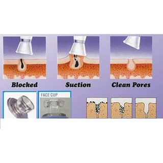 Máy Hút Mụn Mini Spot Cleaner Nhỏ Gọn