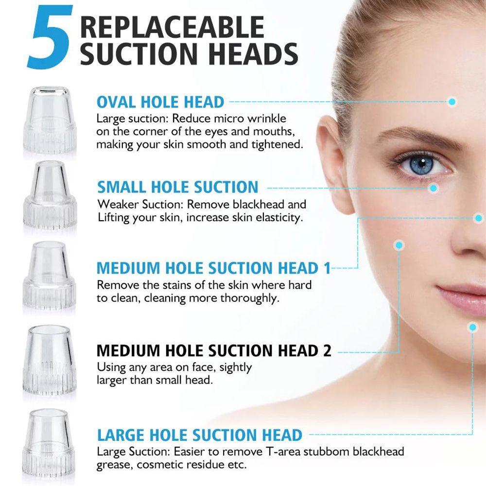 Máy Hút Mụn Đầu Đen Làm Sạch Lỗ Chân Lông