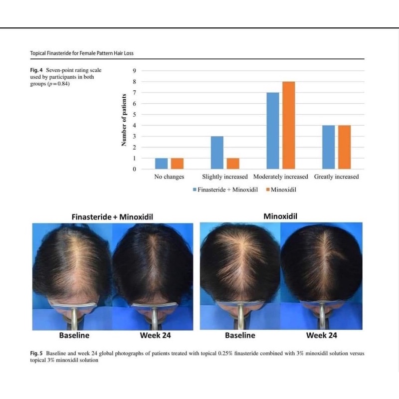Xịt mọc tóc Minoxidil Baiilleul 2% - 5% cứu tinh cho tóc mỏng, tóc hói