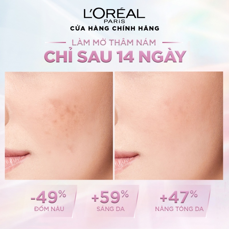 Bộ kem ngày đêm sáng da tức thì Glycolic Bright 50ml x2 &amp; tẩy trang kiềm dầu &amp; chống nắng bảo vệ L'Oreal Paris