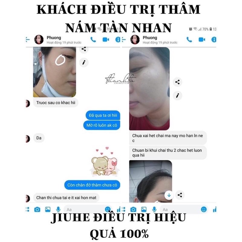 SERUM JIUHE TRI THÂM THANH TÔ BYE BYE  MELANO VER3 CHÍNH HÃNG 100%- SERUM CHUYÊN THÂM NÁM | BigBuy360 - bigbuy360.vn