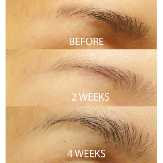 Serum mọc lông mày Revitabrow Advanced 3D - mẫu mới