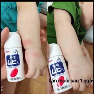 Lăn bôi muỗi đốt Muhi nhật bản