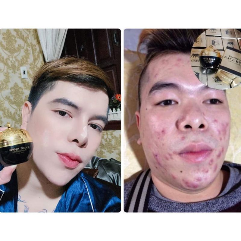 (combo 2hộp)Kem face 5in1 thái lan.