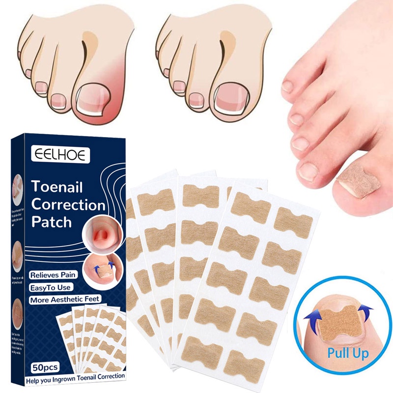 Bộ 50 Miếng Dán Chỉnh Sửa Móng Chân Mọc Ngược
