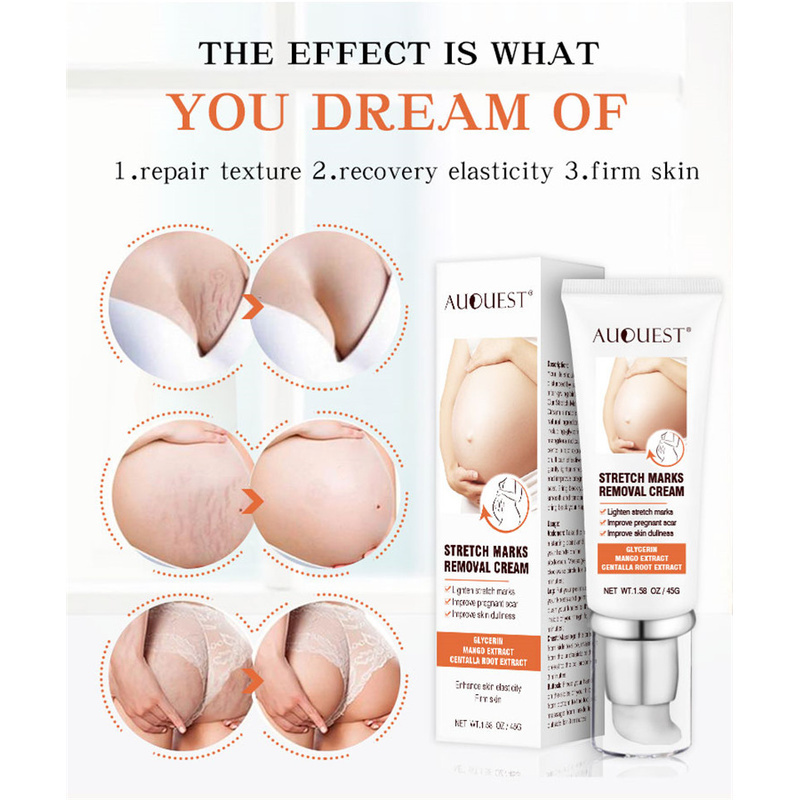 【Ready Stock】 AUQUEST Pregnant Belly Line Cream Cross-border Belly Firming Cream Reduce Postpartum Obesity Stretch Mark Repair Cream 【TB】