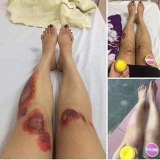 kem mul rose mới nhất