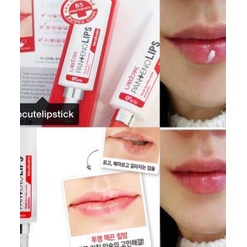 Son Dưỡng Giảm Thâm Môi Mediheal LABOCARE PANtENO LIPS 10ml