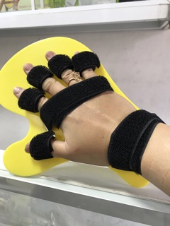 Nẹp cố định bàn tay