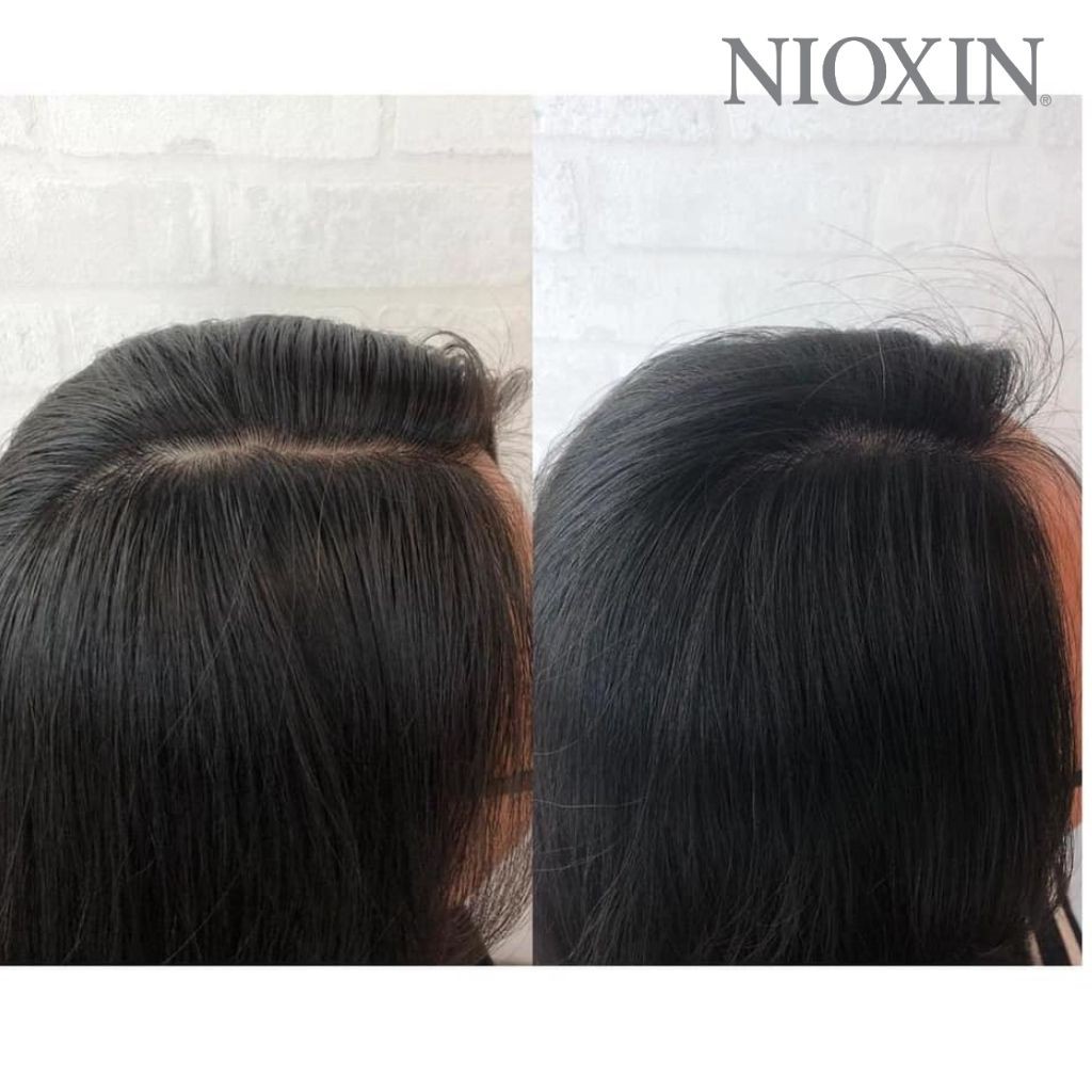 Bộ Chăm Sóc Tóc Nioxin 6 Cho Tóc Tạo Kiểu, Thưa, Rụng Nhiều Bleached / Chemically Treated Hair With Progressed Thinning