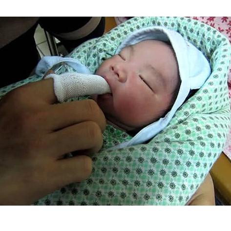 Rơ lưỡi Đông Pha tưa lưỡi an toàn cho bé sơ sinh