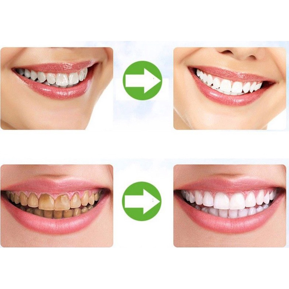 Than hoạt tính trắng răng hữu cơ 70g SUZIKO, đánh răng sạch mảng bám và cao răng hiệu quả