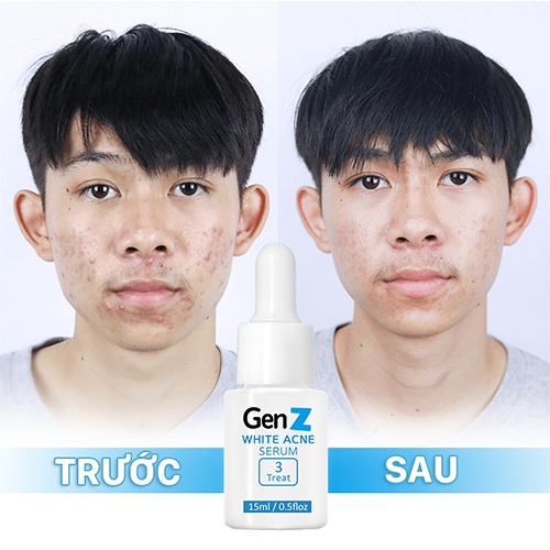 💯   Serum Giảm Mụn Oriskin GenZ White Acne Serum Loại Bỏ Các Loại Mụn 15ml