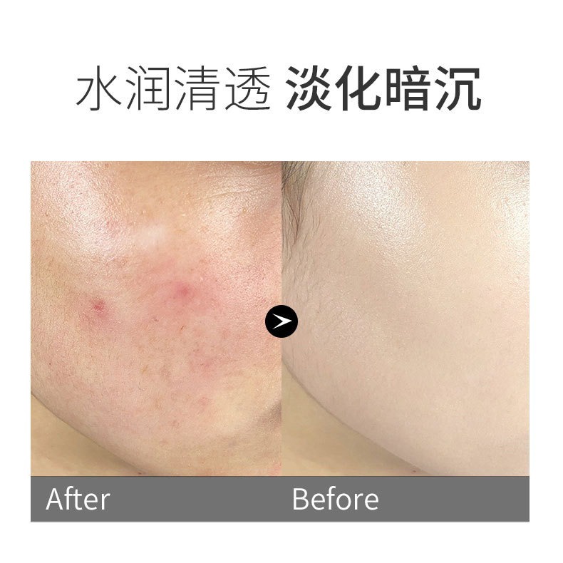 Kem Nền Che Khuyết Điểm Lameila Chống Nước Lâu Trôi Dưỡng Ẩm Cho Da