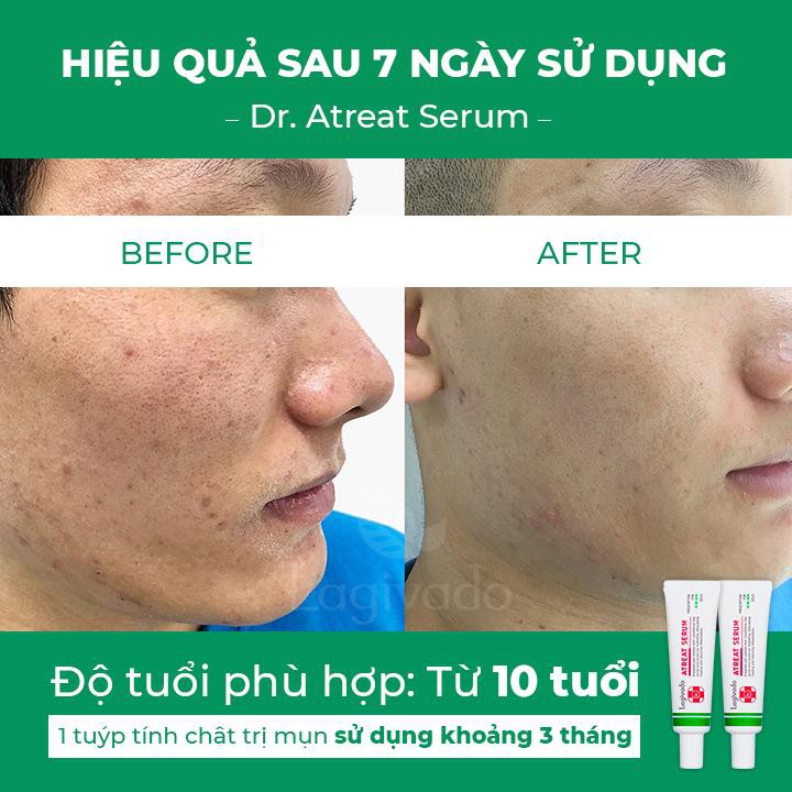 Bộ chăm sóc da mụn Hàn Quốc Lagivado gồm Dr. Atreat Cream 30g &amp; Dr. Atreat Serrum 30ml