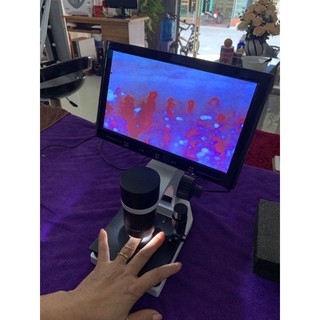 kính soi máu chất lượng SK-8