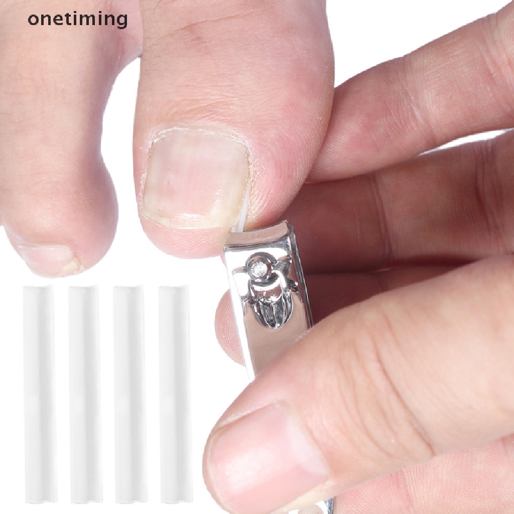 Đệm Silicone Hỗ Trợ Định Hình Móng Tay