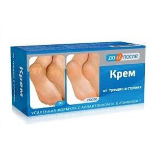 Kem trị nứt gót chân Kpem