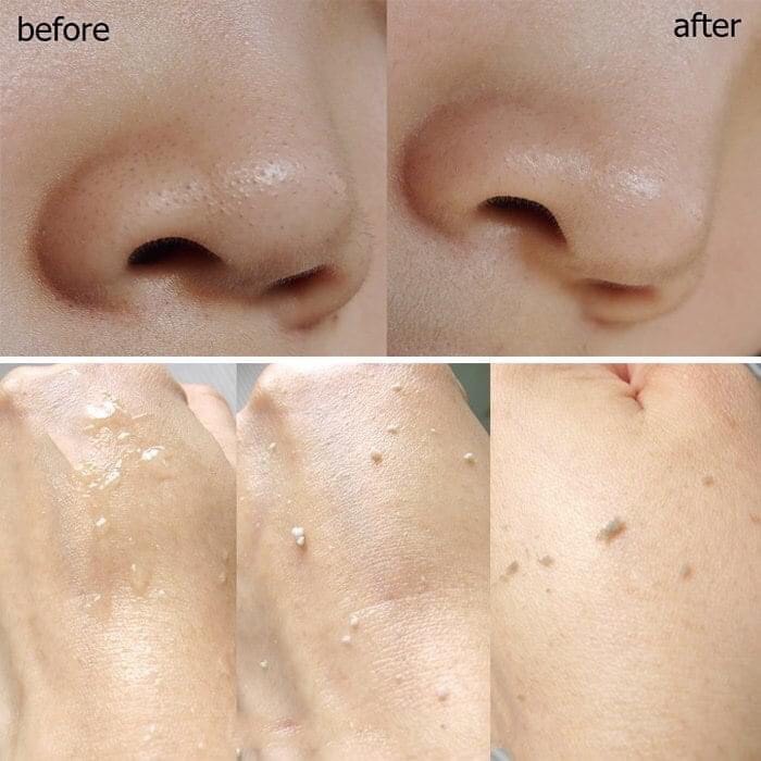 💦 [ CHÍNH HÃNG 100% ] Tẩy da chết Meishoku Detclear Bright & Peel 💎