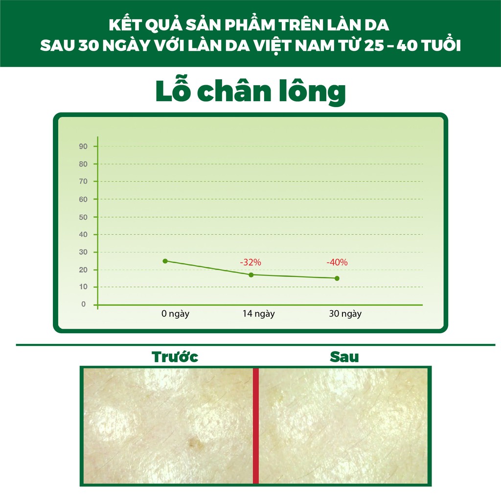 Bộ chăm sóc da mặt Hàn Quốc Lagivado gồm Cream NATIN CEUTIC 50 g và sữa rửa mặt Creamy Foam 50ml.