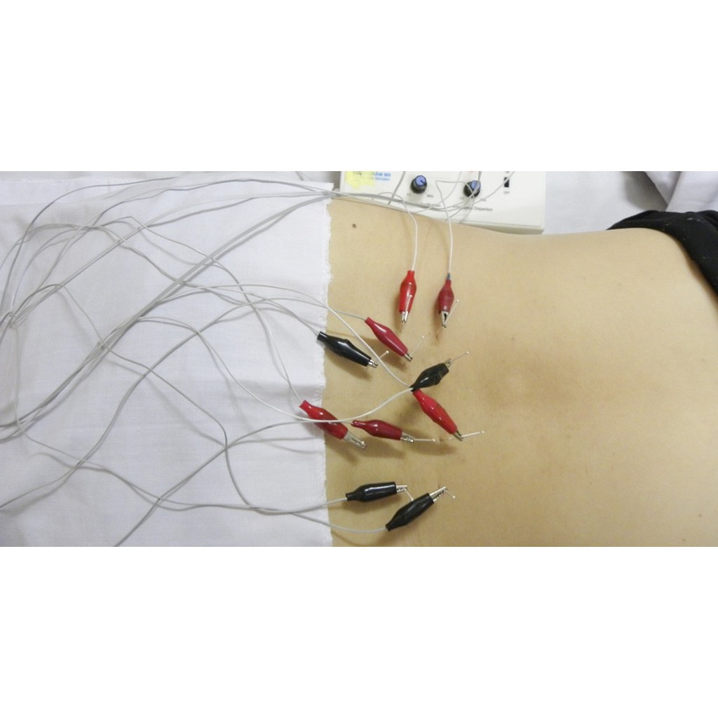 Máy Châm Cứu - Máy Điện Châm Mini ACUPUNCTURE UNIT 3 Giắc 12 kim