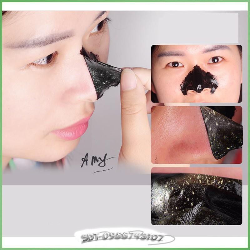 Gel lột mụn cám mụn đầu đen AGD4 | BigBuy360 - bigbuy360.vn