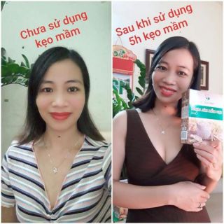 3 hộp kẹo mầm lúa mạch 37