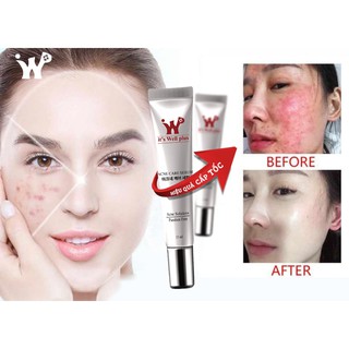 Serum Ngừa Và Giảm Mụn Sẹo It's Well Plus Acne Care Serum 15ml