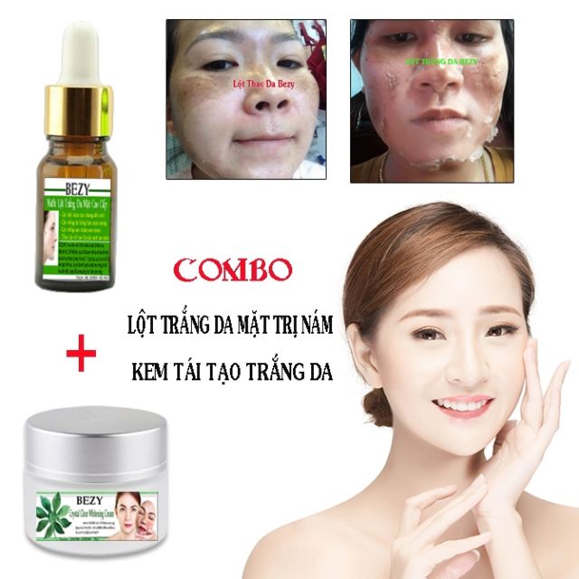 COMBO KEM LỘT TRẮNG DA NÁM