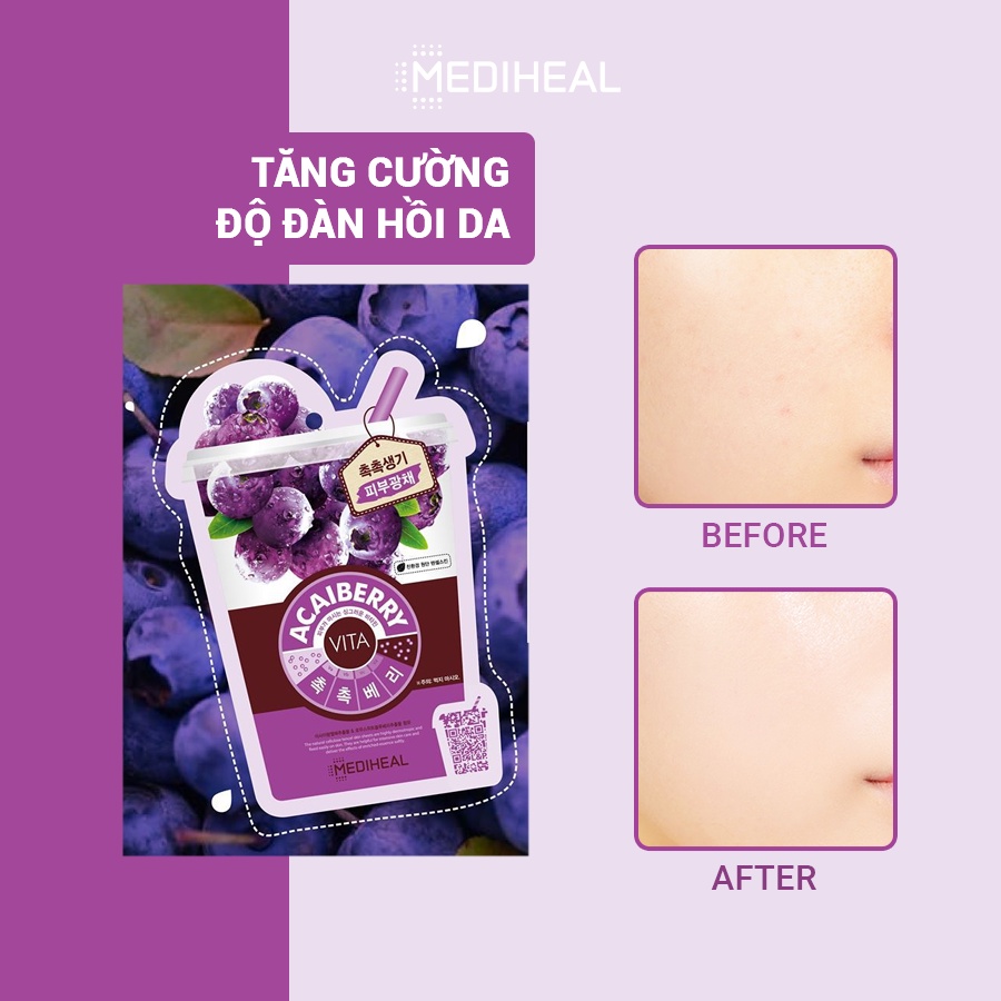 [Nhập mã COSMH22 giảm 8%] Mặt Nạ Tinh Chất Việt Quất Ngăn Ngừa Lão Hóa Da Mediheal Acaiberry Vita Mask 20ml [K16]