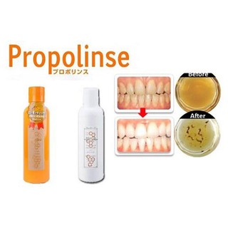NƯỚC SÚC MIỆNG NHẬT BẢN PROPOLINSE
