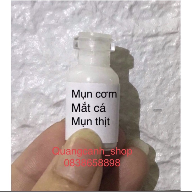 Tẩy nốt ruồi, tàn nhang, mụn cóc , mụn thịt HandMade (lọ 2ml)