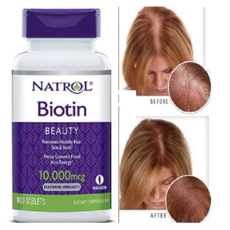 Viên uống hỗ trợ mọc tóc , giảm rụng tóc Biotin Natrol - Lọ 100 viên