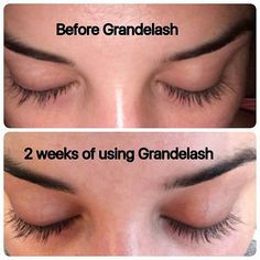 Chuốt dưỡng mi dài và dày Grande Lash MD Lash Enhancing Serum Grande Cosmetics