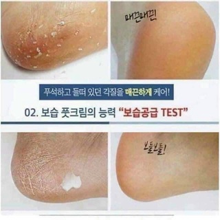 kem bôi nứt gót chân Hàn quốc