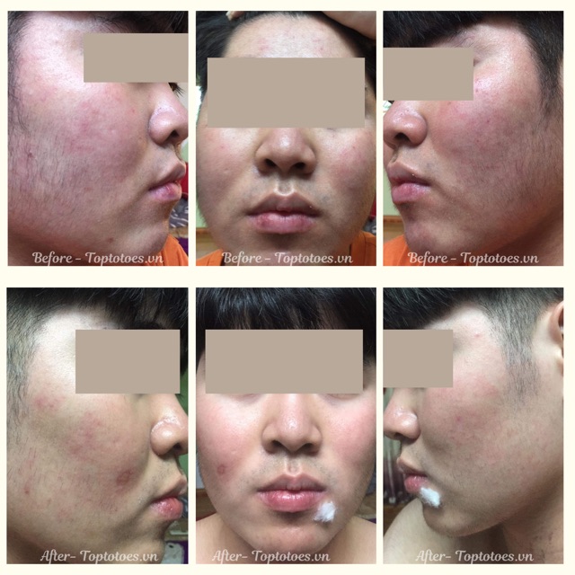 Kem dưỡng Teana Sensocalm Molecular Micro Fluid 50ml làm dịu, dưỡng ẩm, phục hồi sâu da