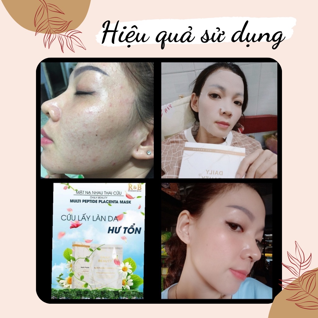 Mặt Nạ Nhau Thai Cừu Daily Beauty Hanny Beauty Multi Peptide Placenta Mask Hộp 6 Miếng