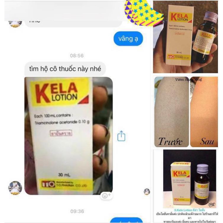 LOTION LOẠI NGỪA VIÊM LỖ CHÂN LÔNG KELA THÁI LAN | BigBuy360 - bigbuy360.vn