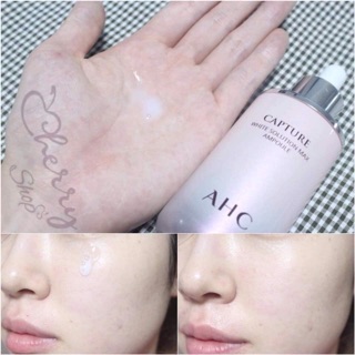 Serum dưỡng da AHC HỒNG