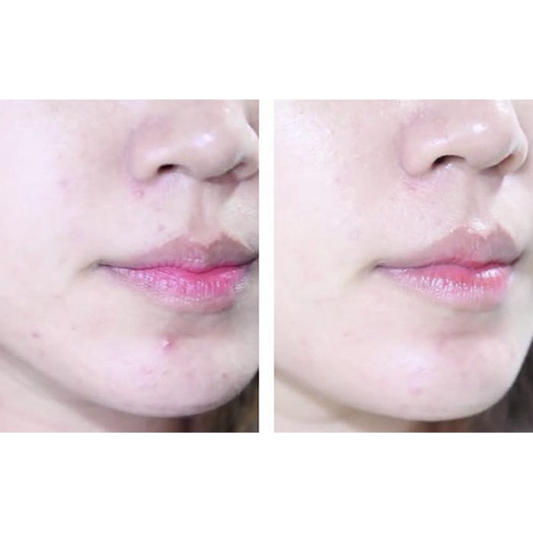 Nước Hoa Hồng Dokudami Giảm Mụn Chiết Xuất Diếp Cá, Tía Tô Natural Skin Lotion 500ml NPP Shoptido | BigBuy360 - bigbuy360.vn