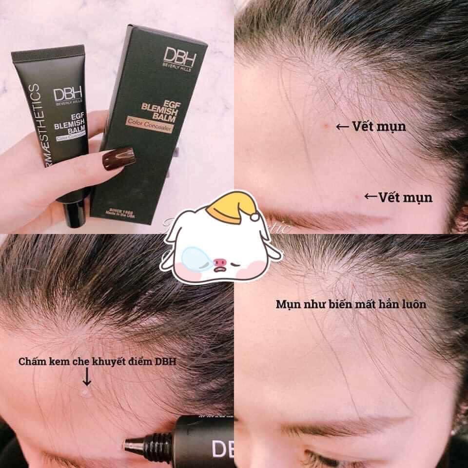 Kem che khuyết điểm DBH EGF Blemish Balm Color Concealer 20ml