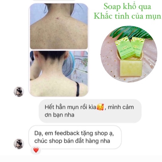 [Handmade] Xà bông thiên nhiên Khổ qua matcha hỗ trợ giảm mụn lưng mụn cơ thể dành cho body
