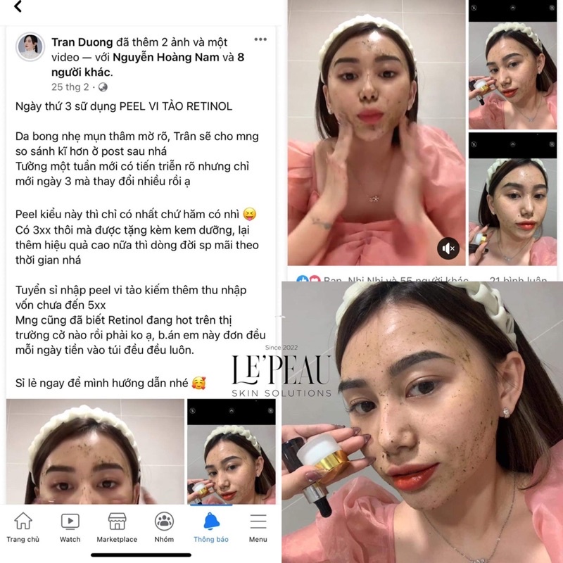 Peel da retinol vi tảo Le'Peau 10ml, Serum giảm mụn, tái tạo da sinh học, tặng kèm Serum B5 phục hồi,Hiệu quả sau 7 ngày