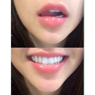 Mặt Nạ Ngủ Môi Langie