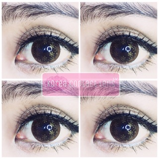 Lens kim tuyến phiên bản đặc biệt