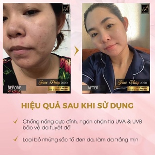 Combo Kem Face Pháp và Serum Spot A Cosmectics