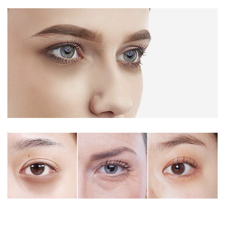 [Sỉ-Rẻ] Kem dưỡng mắt trứng cá tầm Venzen Niacinamide chăm sóc vùng da mắt bị nhăn, bọng mắt và quầng thâm 20g – DT12 | BigBuy360 - bigbuy360.vn